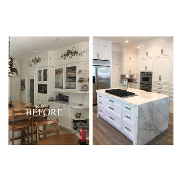 Before & After Gallery