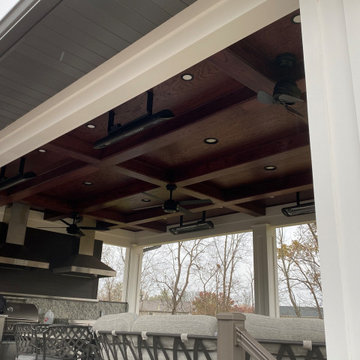 Composite Deck, Covered Outdoor Kitchen Oasis with Vertical Aluminum Railing