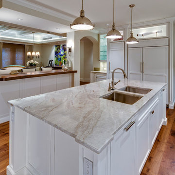 Naples Pelican Bay Carlton Place Villa Remodel