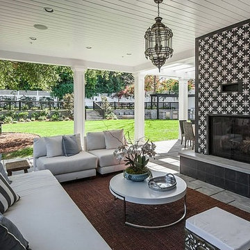 Outdoor Sitting Area & Fireplace | Encino