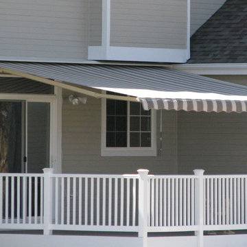 Retractable Awning - Littleton