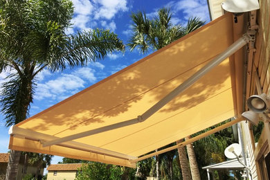 Retractable Awning - Private Residence (Atlantic Beach)