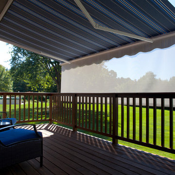 Retractable Awning with Drop Shade