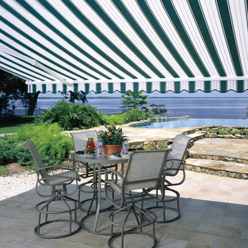 Retractable Awnings from Sunesta