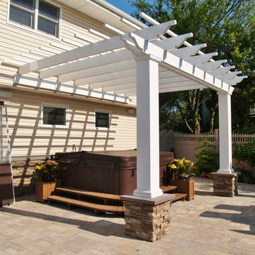 Ultimate Backyard Renovation