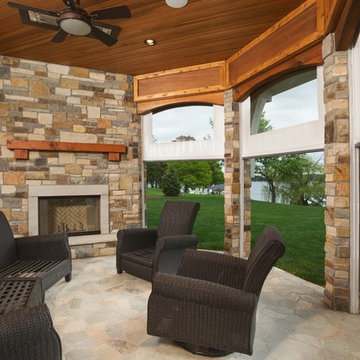Double Roller Patio