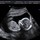 shani_earwood