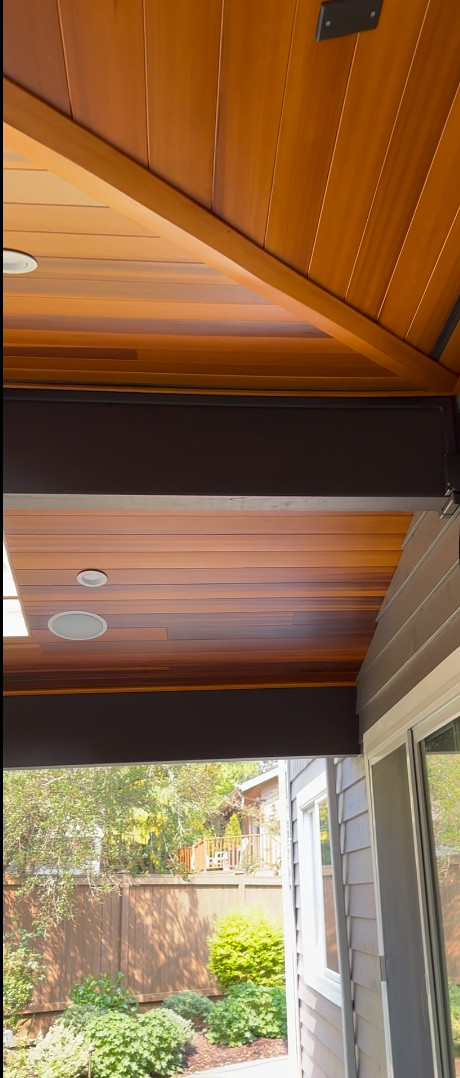 Outdoor Living/Cedar Patio