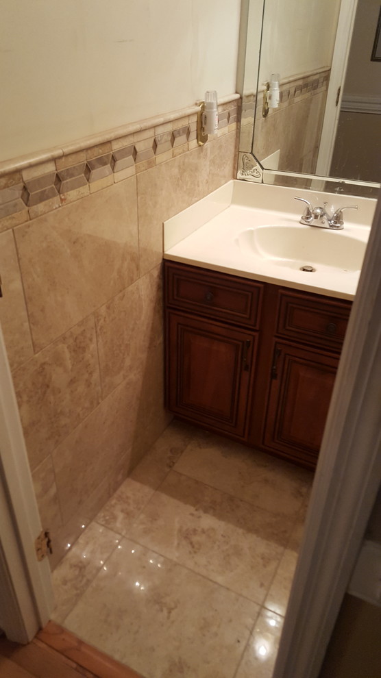 Remodel